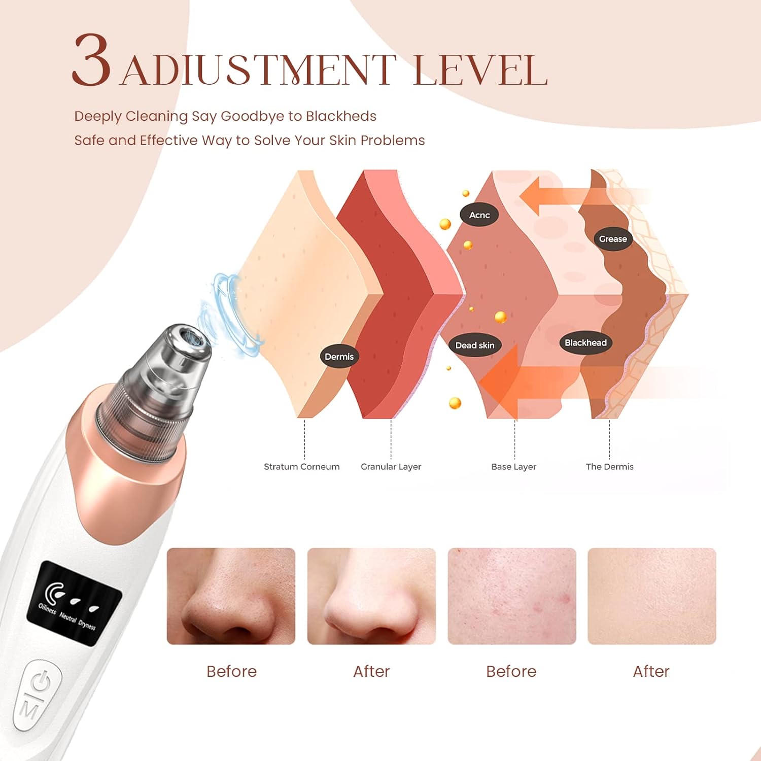 Newest Technology Blackhead Remover Vacuum Pore Cleaner for Face&Nose